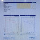 외이도개발술 6년 정도 지난 후기~ 이미지