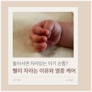 달달해네일 | 신생아 아기 손톱 빨리 자라는 이유와 깎기 팁, 손톱 밑 염증(조갑주위염) 관리법