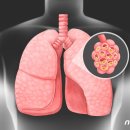 만성 피로 느끼는 중년여성 &#39;이 질환&#39;일수도…&#34;조기진단 중요&#34; 이미지