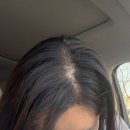 보름 | 휑한 정수리 여성 탈모 앰플 릴리이브 그로우턴 내돈내산 보름후기