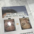 마곡여드름 관리 어디서 받을까? 피부시대 여드름 케어 후기｜기기로 하는 진짜 관리
