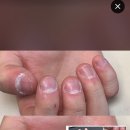 Nail & J | 안성 네일 _ 물어뜯는 손톱 _ 남자손케어 _ 남성케어 _ 남성케어 전문 👉🏻 J왁싱앤뷰티 네일