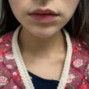 (주)핸디케어 | 차주영 뷰티디바이스 글림빛 원(WON)사용 후기 무너진 얼굴 윤곽 홈케어로 되살리기!