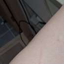 피부과 의사, 약사님 계실까요? 이미지
