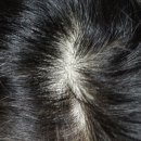 연세팜스의원 | 은평 연세팜스의원 후기 올려 봅니다~!!