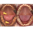 서울아산OK치과 임플란트 '아르플란트' 이 이름을 붙인 이유가 있습니다 <대표원장 작성>
