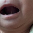 큰사랑소아청소년과의원 네이버블로그