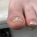 미엘네일 이미지