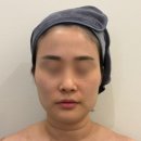 양현로405번길 | [분당/야탑] 야탑 에스테틱 여수동 에스테틱 원에스테틱 성남본점 후기