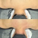 시흥 능곡 10년 전통 피부관리샵 리킴스앤바디 후기 – 가우스 후면 관리로 몸이 가벼워졌어요!