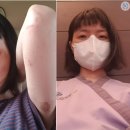 2080연합피부과의원 네이버블로그