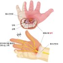 산본한의원 네이버블로그