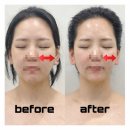 도도피부 | 평택피부관리 고덕동 도도에스테틱 윤곽,비대칭 맞춤케어 후기