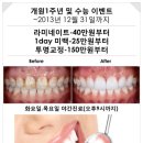 세라믹치과기공소 이미지