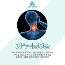 고릴라신경외과의원 네이버블로그