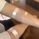 육공장 | 호주워홀 육공장필수 멜버른에서 Q fever(큐피버)백신 접종하기 피검사 스킨테스트 최종접종까지 2주 비용