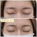 로운 | [건대/군자] 자연스러운 눈썹 시술 만족후기 '조이로운'