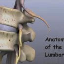 요통(Low Back Pain) Ⅰ. 이미지