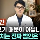 '이 수치' 높으면 당장 병원 가세요. 지방간 방치하면 심장까지 위험하다. 이미지