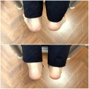스타광고업 | 체형교정 필라테스] H7 체형교정 & 필라테스 1:1 레슨 후기 – 교통사고 후 체형 불균형 교정 이야기
