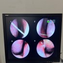 [후기] 미소로한의원 분당점 비염치료 내돈내산 후기