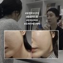 라라약국 | 포항피부관리 프레아에스테틱 관리 받은 찐 후기! "좁쌀 여드름"