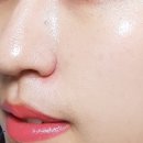 바른메디케어 이미지