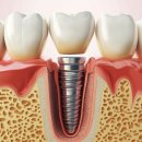 강동뉴욕치과의원 이미지