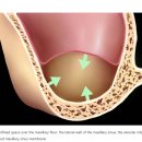 The이해승치과의원 | 기흥역 치과 , 상악동 거상술에 대한 정확한 내용