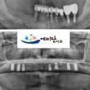 태양치과기공소 이미지