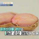 땅콩이 만드는 몸의 변화 이미지