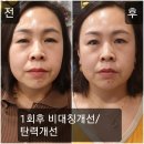 에스테틱. 바디관리실 전용 이미지