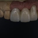 커스텀기공소 이미지