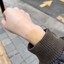 와우로 1L(1->종점) | 성빈센트병원 성형외과에서 얼굴 봉와직염 치료 후기 3탄