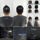 스칼프K 이미지