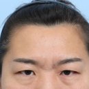 초이성형외과