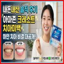 하얀나라화장품 - 울주군 점촌4길 54 | 아마존 크레스트 치아미백, 내돈내산 솔직 후기: 하얀 치아 비결 대공개!