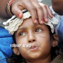 OPD MEDICAL 이미지