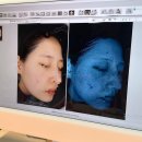 로데오사우나내피부관리실 | 하이엔드 프리미엄 청담동 피부과 전문의 1:1 맞춤 진료 리프팅 소프웨이브 후기