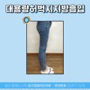 워너비라인의원 이미지