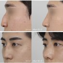 복원하는남자