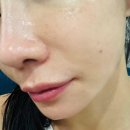 감초약국 | 약국 착색크림 민감러가 쓸 수 있었던 이유