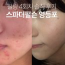 영등포피부관리샵 긴가민가했던 필링 4회차 솔직후기 스파더펄슨