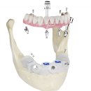 나비덴탈 이미지