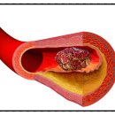 경희강추한의원 이미지