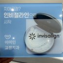 동대문미소치과의원 | 군자역 치아교정 상담 후기｜비용·기간·장치까지 한 번에 정리해본 리얼 후기