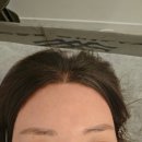 853 | [일산] 왁싱853-일산왁싱 헤어라인 솔직후기