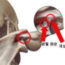 고려외과학연구소 | 내적 충돌 증후군(Internal impingement syndrome)