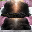 대구SMP