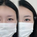 브로우페페
